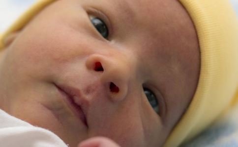 春季预防宝宝患3种眼病