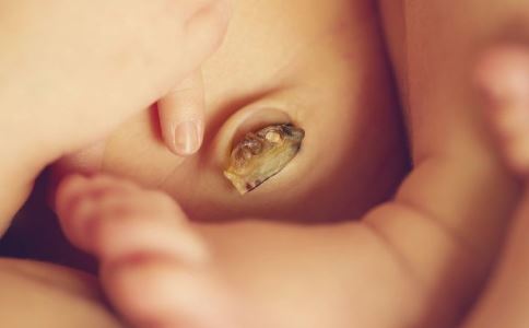 新生儿脐带如何护理 宝宝脐带发炎了怎么办 新生儿脐带发炎怎么办