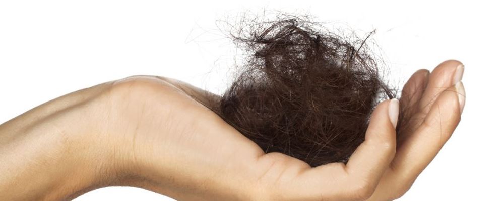 产后脱发怎么办 产后脱发的解决方法 产后脱发是一种正常的现象吗