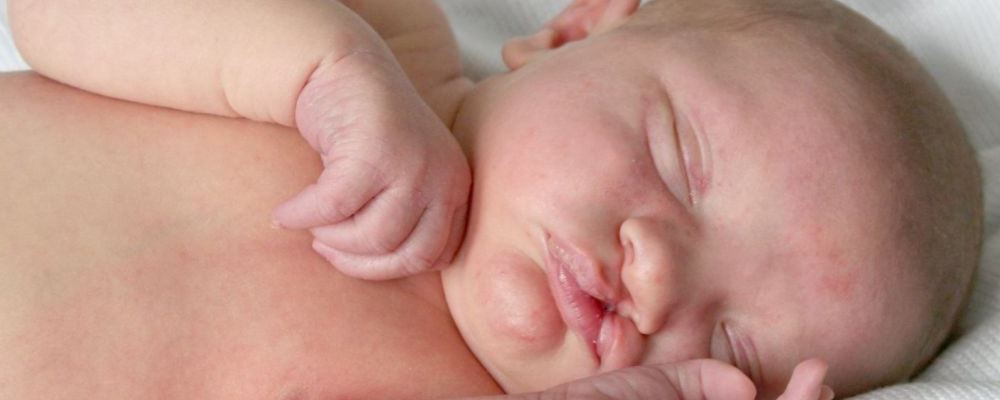 新生儿黄疸多久能消退 使黄疸退得快有哪些方法 宝宝黄疸怎样退的快