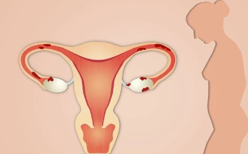 输卵管造影后怀孕 女性输卵管造影检查 子宫输卵管造影